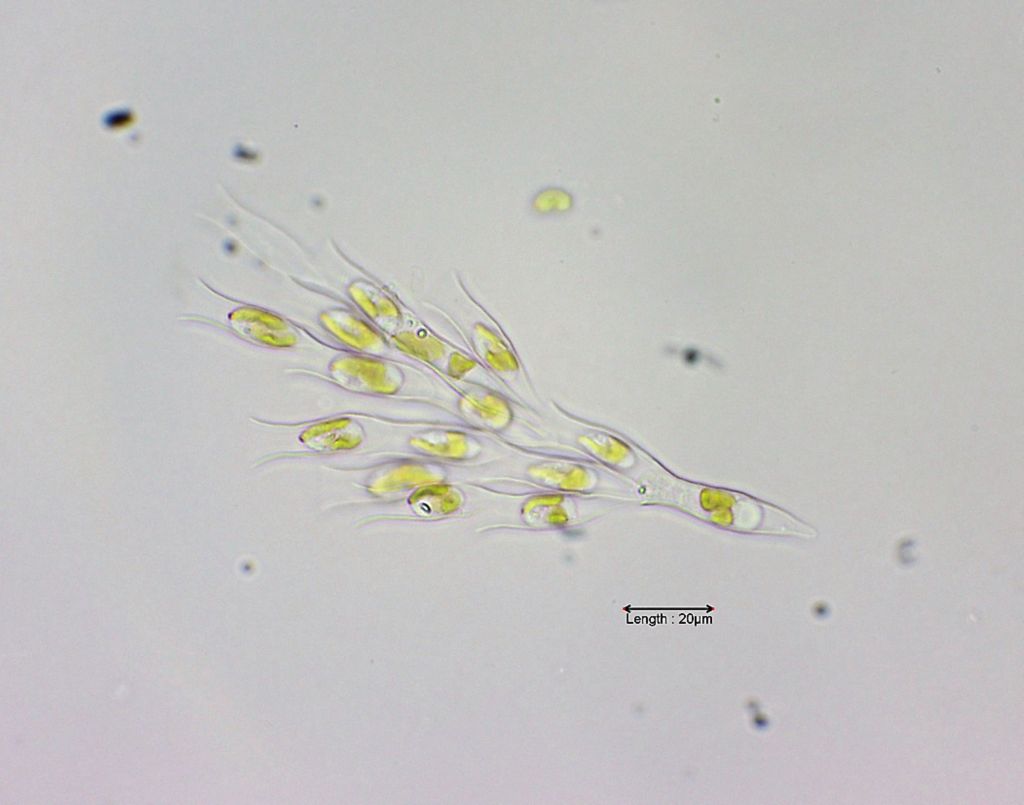 Dinobryon sertularia