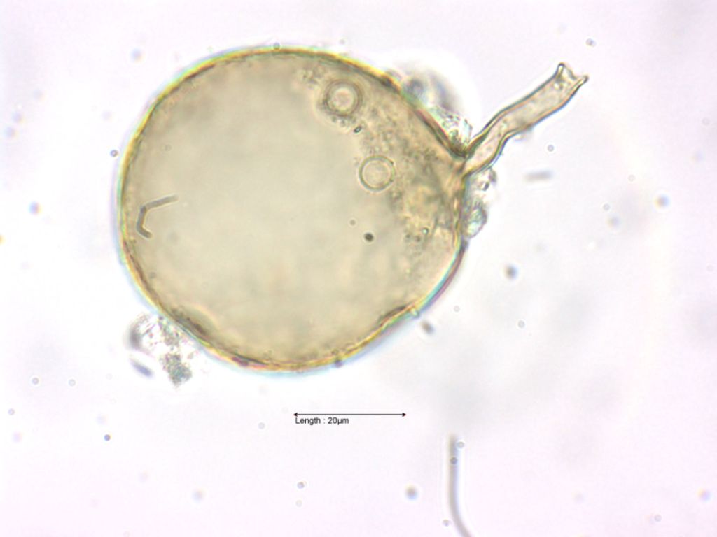 chlamydospore of Glomus spec.
